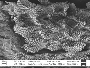 Media type: image;   Invertebrate Zoology 32029 Description: SEM image of specimen.;  Aspect: dorsal
